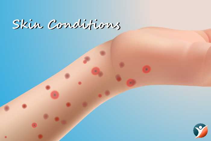 skin conditions while suffering from diabetes