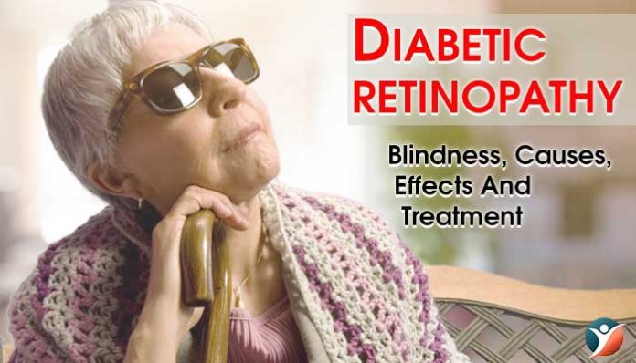 diabetes retinopathy