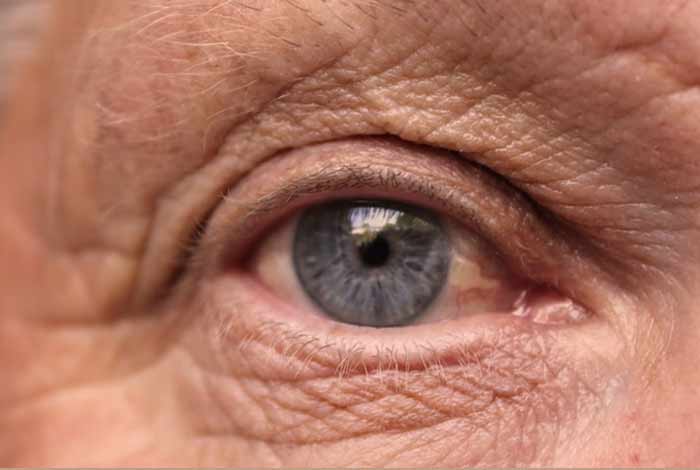 learn more about the association between alzheimer's and degenerative eye diseases