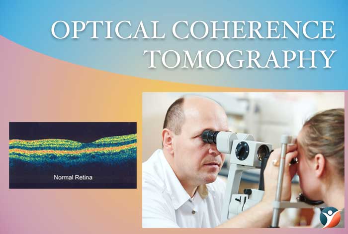 optical coherence tomography 