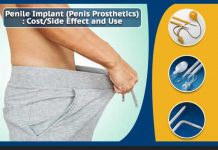 penile implants
