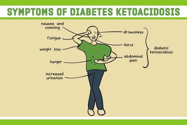 Diabetes Ketoacidosis DKA Causes Symptoms Treatment