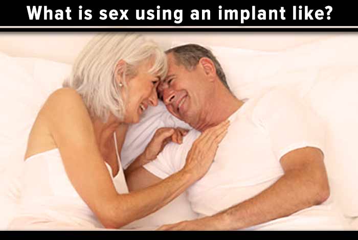 what is sex using an implant like