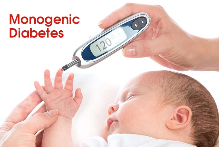 Monogenic Diabetes