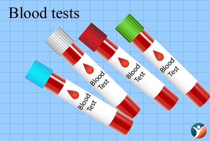  Other blood tests