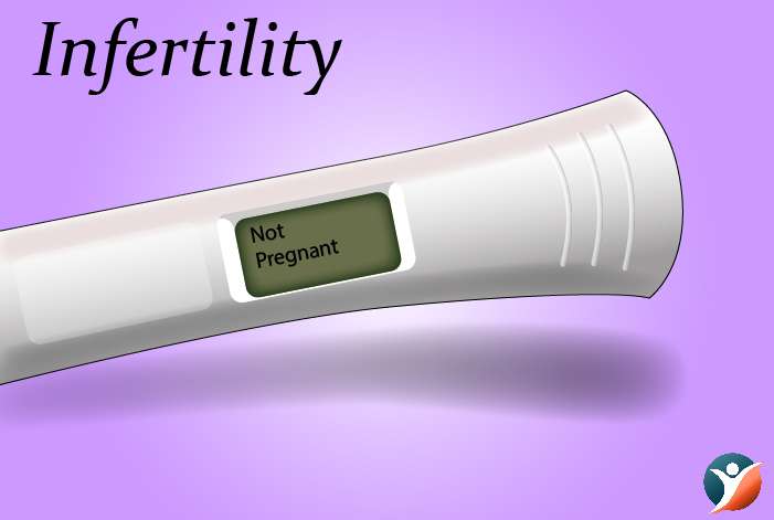  Infertility