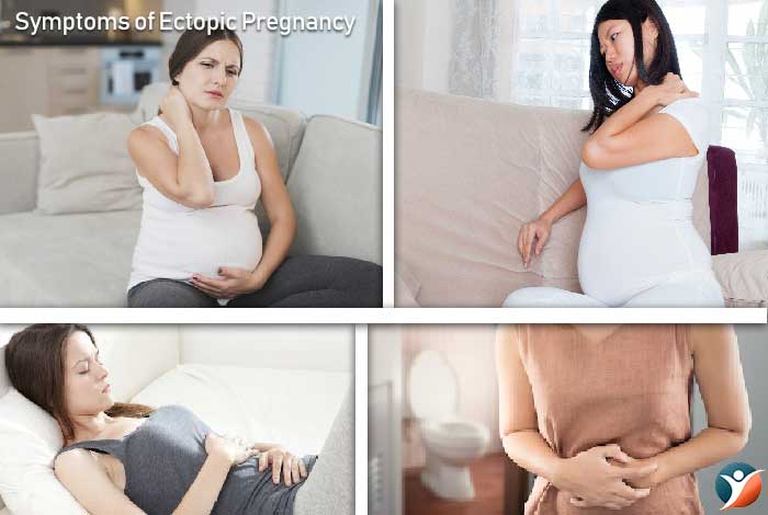 Symptoms of Ectopic Pregnancy