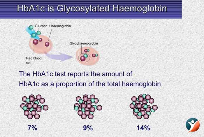 HbA1c for diabetes