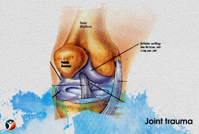 Joint trauma