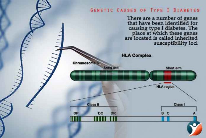 genetic research type 1 diabetes
