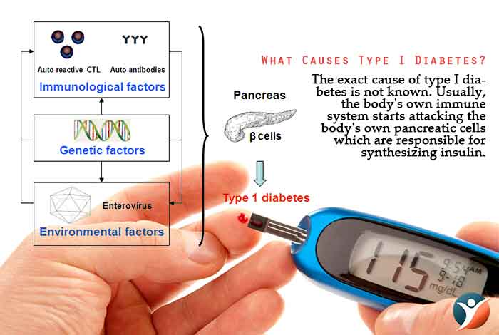 Causes of Type 1 Diabetes Know More!