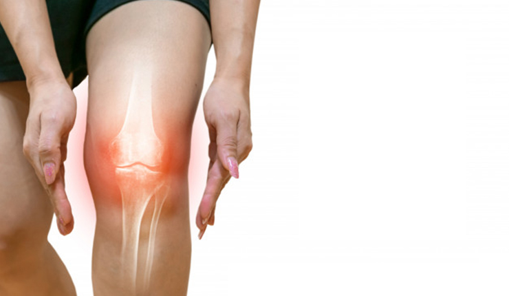 reactive arthritis 