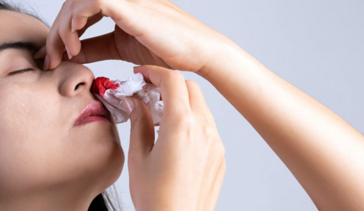 10-common-causes-of-episodic-nose-bleeding