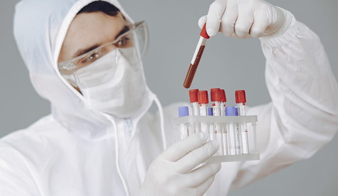 New-Blood-Test-May-Tell-How-Well-You-Are-Aging